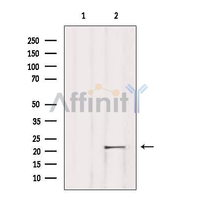 TNFAIP8L1 Antibody - Western blot analysis of extracts from Rat lung, using TNFAIP8L1 Antibody.
