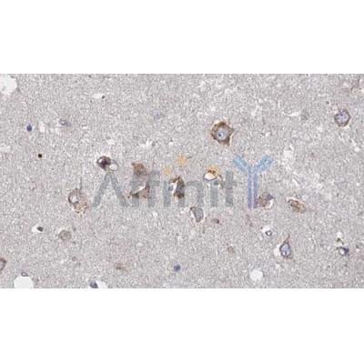 5HT2A Receptor Antibody - DF8900 at 1/100 staining human brain tissue sections by IHC-P.