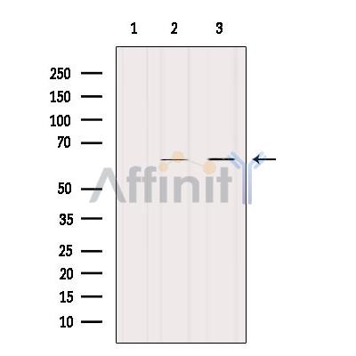 Cytokeratin 9 Antibody - Western blot analysis of extracts from various samples, using Keratin 9 Antibody.