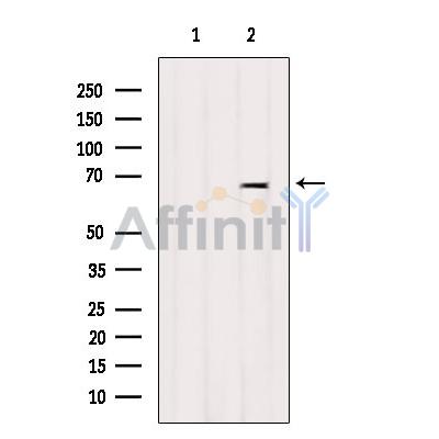 ARSJ Antibody - Western blot analysis of extracts from Mouse lung, using ARSJ Antibody.