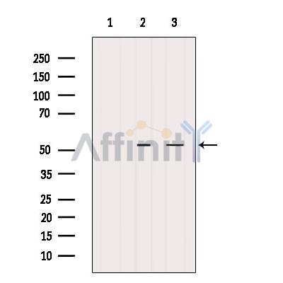 BAGE5 Antibody - Western blot analysis of extracts from various samples, using BAGE5 Antibody.