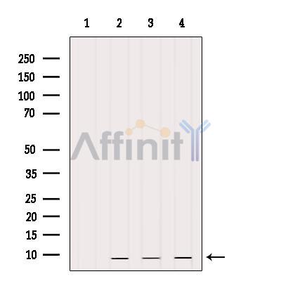 PCP4 Antibody - Western blot analysis of extracts from various samples, using PEP-19 Antibody.