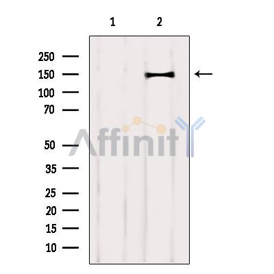 CNTNAP4 Antibody - Western blot analysis of extracts from Mouse brain, using CNTNAP4 Antibody.