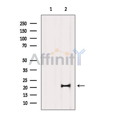 MED29 Antibody - Western blot analysis of extracts from Mouse brain, using MED29 Antibody.