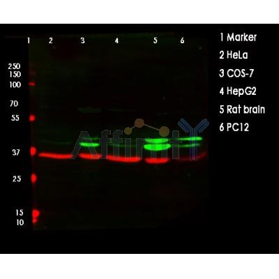 ERK1/2 Antibody - Western blot analysis of ERK1/2 using various lysates   Lanes 1 - 2: Merged signal (red and green).