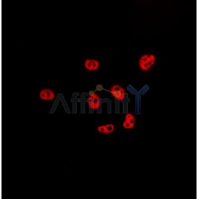 KLF11 Antibody - AF0315 staining Hela by IF/ICC.
