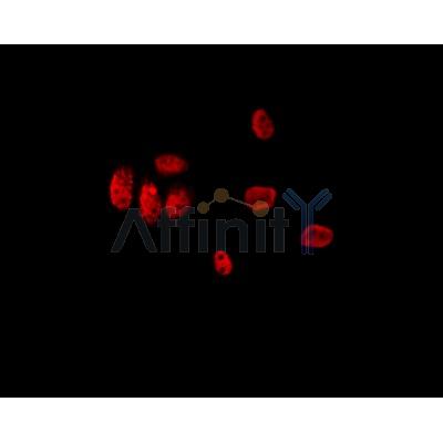 LMX1B Antibody - AF0341 staining Hela by IF/ICC.