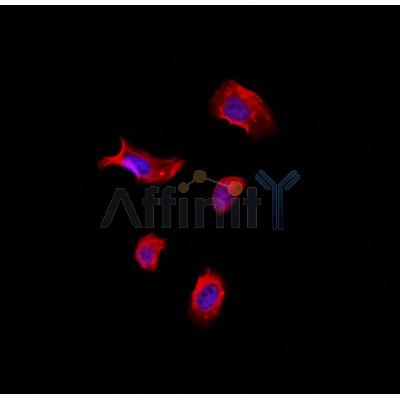 TACC1 Antibody - AF0456 staining Hela by IF/ICC.