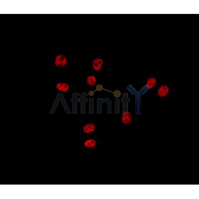 ZNF148 Antibody - AF0792 staining Hela by IF/ICC.