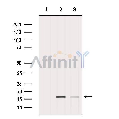 TOMM20 Antibody - Western blot analysis of extracts from various samples, using TOMM20 Antibody.