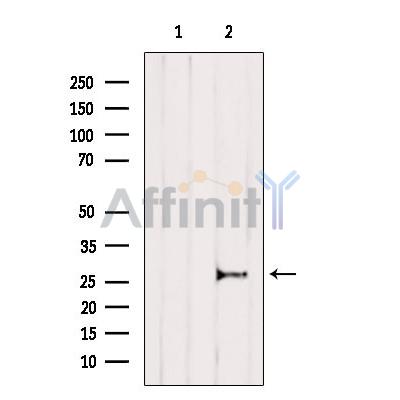 IL11 Antibody - Western blot analysis of extracts from Mouse brain, using IL 11 Antibody.