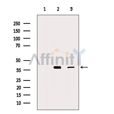 FAS Antibody - Western blot analysis of extracts from various samples, using FAS Antibody.