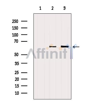 SQSTM1/p62 Antibody - Western blot analysis of extracts from various samples, using P62/SQSTM1 Antibody.