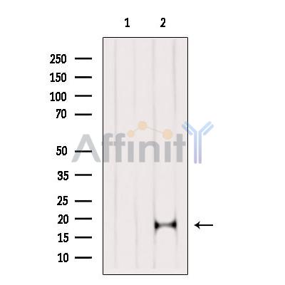 COX IV Antibody - Western blot analysis of extracts from MCF7, using COX IV Antibody.