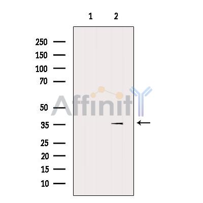 SLC30A2 Antibody - Western blot analysis of extracts from Mouse liver, using SLC30A2 Antibody.