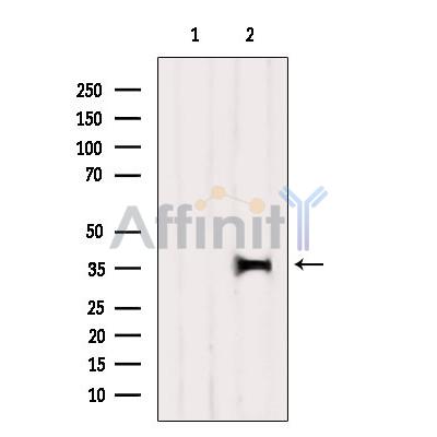 OR52M1 Antibody - Western blot analysis of extracts from Rat brain, using OR52M1 Antibody.