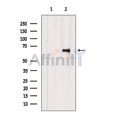 BCO2 Antibody - Western blot analysis of extracts from Rat lung, using BCO2 Antibody.