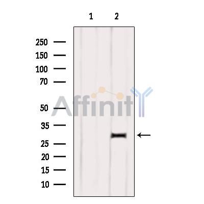 DIO1 Antibody - Western blot analysis of extracts from Rat muscle, using DIO1 Antibody.