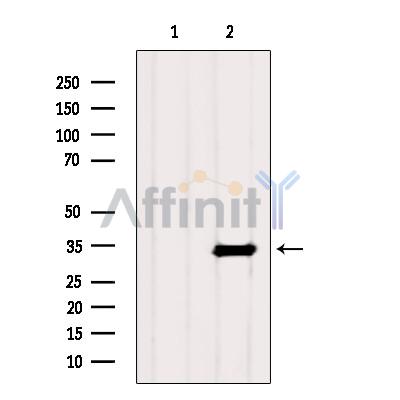 PHF11 Antibody - Western blot analysis of extracts from Mouse heart, using PHF11 Antibody.