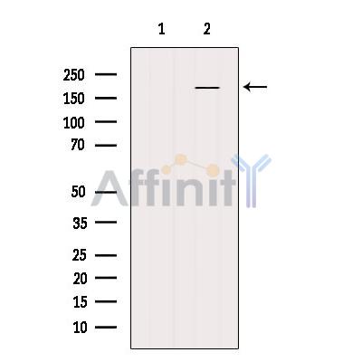 NRK Antibody - Western blot analysis of extracts from MCF7, using NRK Antibody.