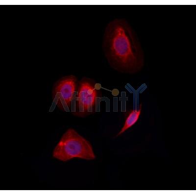 SLC7A4 Antibody - DF3906 staining Hela by IF/ICC.