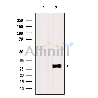 RAB20 Antibody - Western blot analysis of extracts from Rat muscle, using RAB20 Antibody.