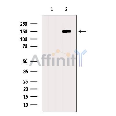 GPR116 Antibody - Western blot analysis of extracts from Myeloma cells, using GPR116 Antibody.