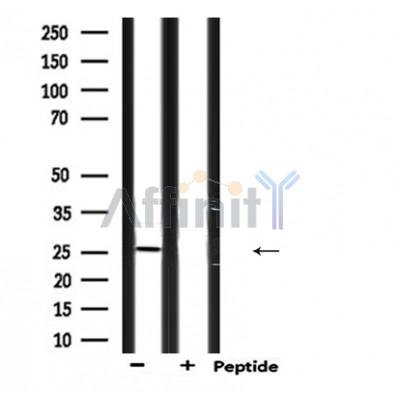 EDN3 Antibody - Western blot analysis of extracts from mouse brain, using EDN3 Antibody.