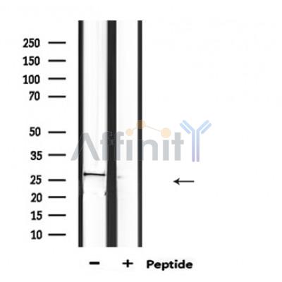 PRSS1 Antibody - Western blot analysis of extracts from mouse brain, using PRSS1 Antibody.
