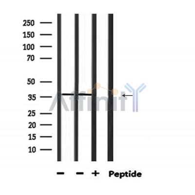 ELAVL1 Antibody - Western blot analysis of extracts from mouse brain and rat spleen, using ELAVL1 Antibody.