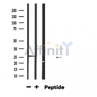 GADD45A Antibody - Western blot analysis of extracts from HepG2, using GADD45A Antibody.