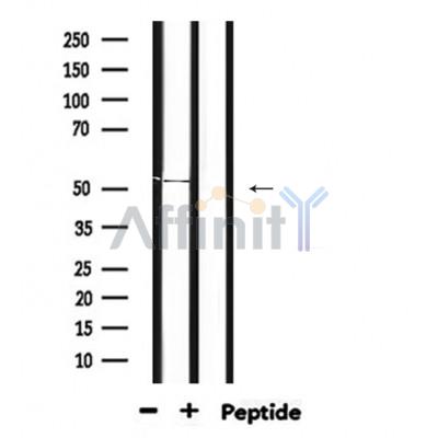 GABRA2 Antibody - Western blot analysis of extracts from mouse heart, using GABRA2 Antibody.