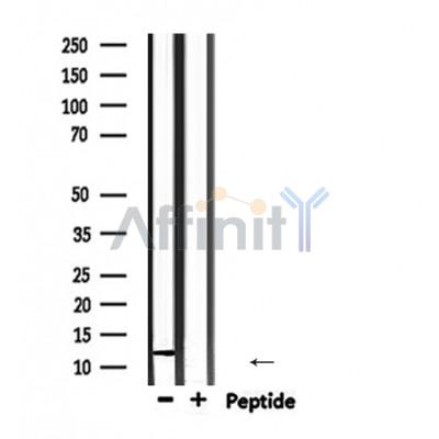 RBX1 Antibody - Western blot analysis of extracts from mouse heart, using RBX1 Antibody.