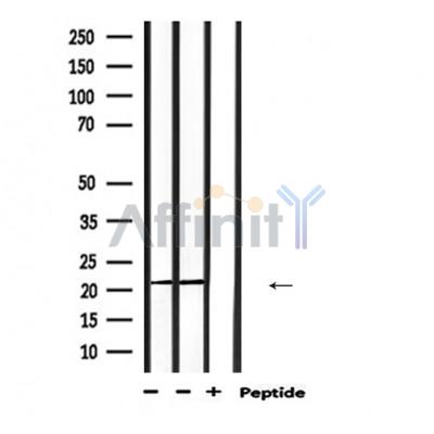 Peroxiredoxin 2 Antibody - Western blot analysis of extracts from mouse muscle, using PRDX2 Antibody.