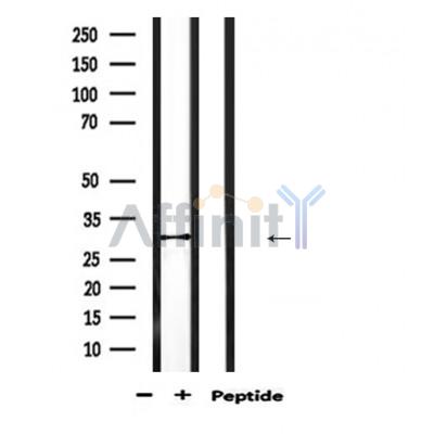 CBR1 Antibody - Western blot analysis of extracts from mouse kidney, using CBR1 Antibody.