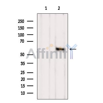 KR2_HHV11 Antibody - Western blot analysis of extracts from B16F10, using KR2_HHV11 Antibody.