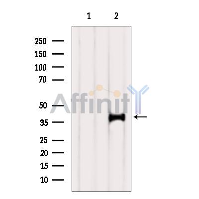 SH3GL3 Antibody - Western blot analysis of extracts from Rat  spleen, using SH3GL3 Antibody.