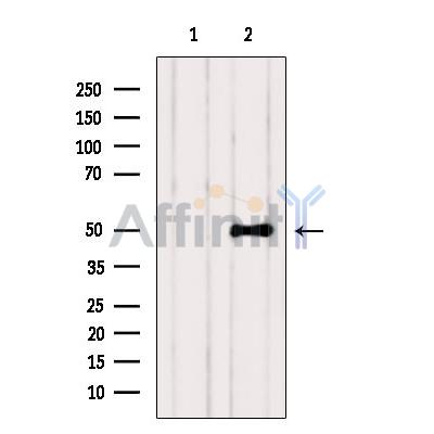 ZNF436 Antibody - Western blot analysis of extracts from VERO, using ZNF436 Antibody.