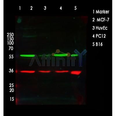 pan-AKT1/2/3 Antibody - Western blot analysis of AKT1/2/3 using various lysates  Lanes 1 - 2: Merged signal (red and green).