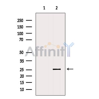 CD8 Antibody - Western blot analysis of extracts from HepG2, using CD8A Antibody.