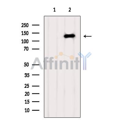 TYK2 Antibody - Western blot analysis of extracts from Hela, using TYK2 Antibody.