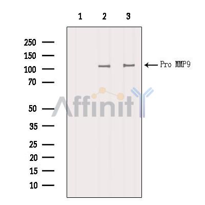 MMP9 Antibody - Western blot analysis of extracts from various samples, using MMP-9 Antibody.