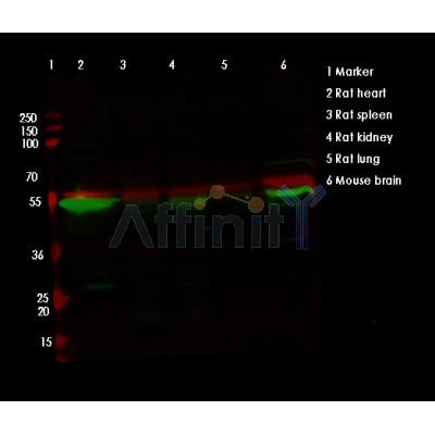 TFEB Antibody - Western blot analysis of TFEB using various lysates   Lanes 1 - 2: Merged signal (red and green).