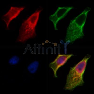 Phospho-IRE1 (Ser724) Antibody - AF7150 staining Hela cells by IF/ICC.