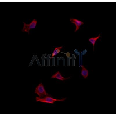 NOD2 Antibody - DF12125 staining HepG2 by IF/ICC.