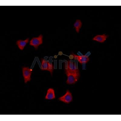 Estrogen Sulfotransferase Antibody - DF12137 staining HepG2 by IF/ICC.