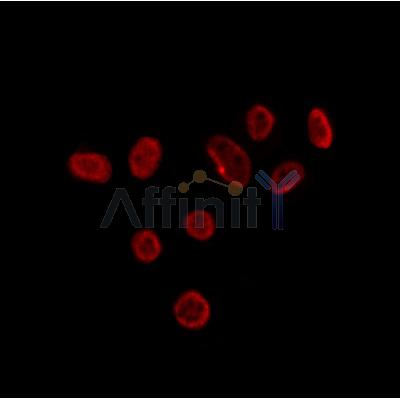 TIA1 Antibody - DF12176 staining HepG2 by IF/ICC.