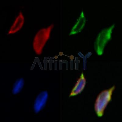 EXOC1 Antibody - DF12201 staining Hela by IF/ICC.