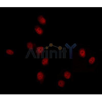DYX1C1 Antibody - DF12270 staining HepG2 by IF/ICC.