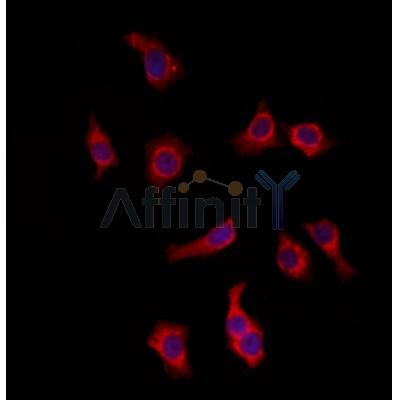 KIFC3 Antibody - DF12287 staining HepG2 by IF/ICC.